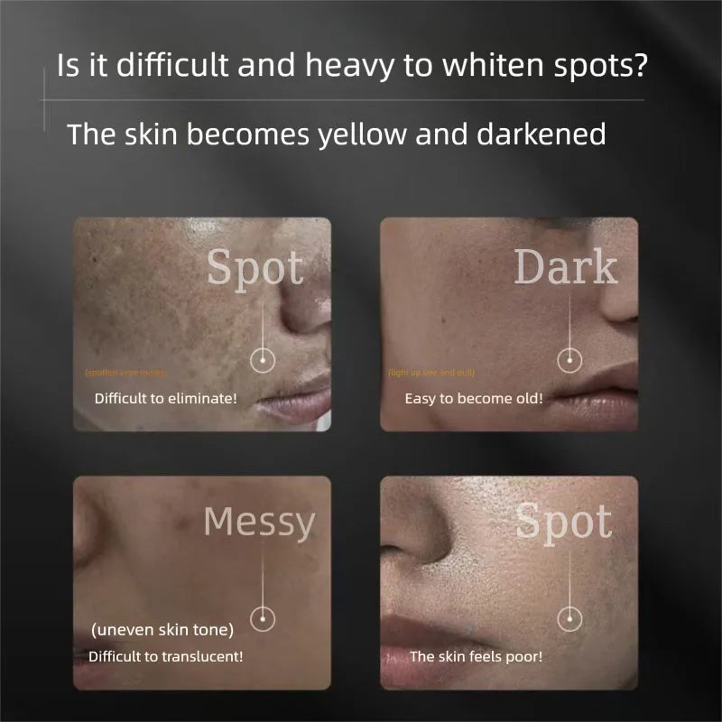 Remove Freckles Brighten Essence Moisturizing Whitening Serum Korean Facial Skin Care Beauty Health