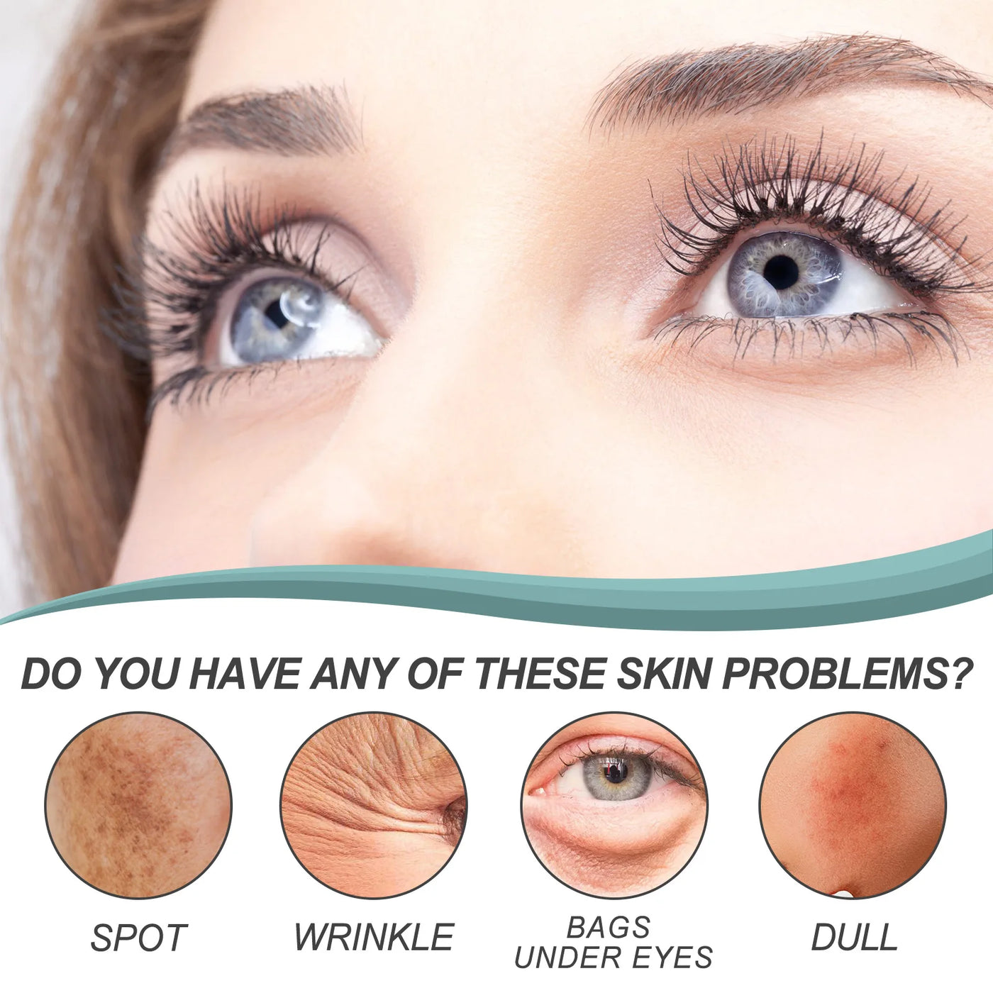 EELHOE Dark Spot Remover Face Cream Pigmentation Removal Melasma Remove Deep Hydration Skin Brightening Anti Freckle Cream 30g