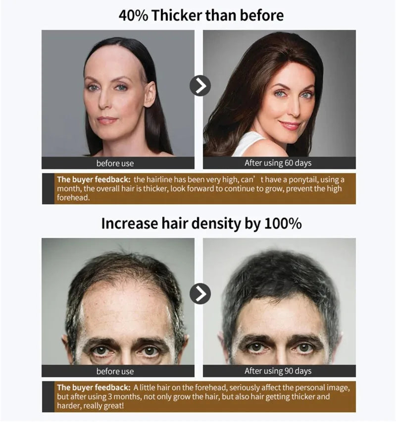 Hair Growth Serum Spray Ginger Anti Hair Loss Treatment Products Repair Nourish hair Roots Fast Regrowth Men Women