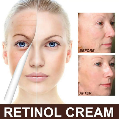 1pcs Retinols Face Cream Remove Wrinkle Anti-Aging Fade Fine Lines Face Cream Instant Face Lift Retinols Cream For Face